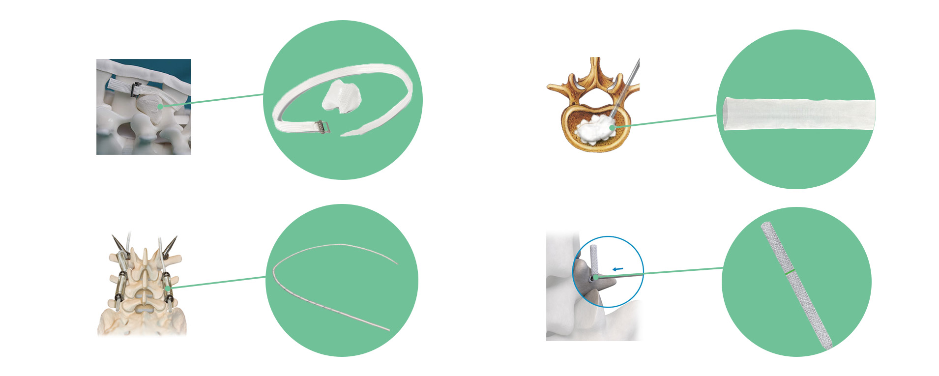 1755481853774124.jpg 官网脊柱外科.jpg