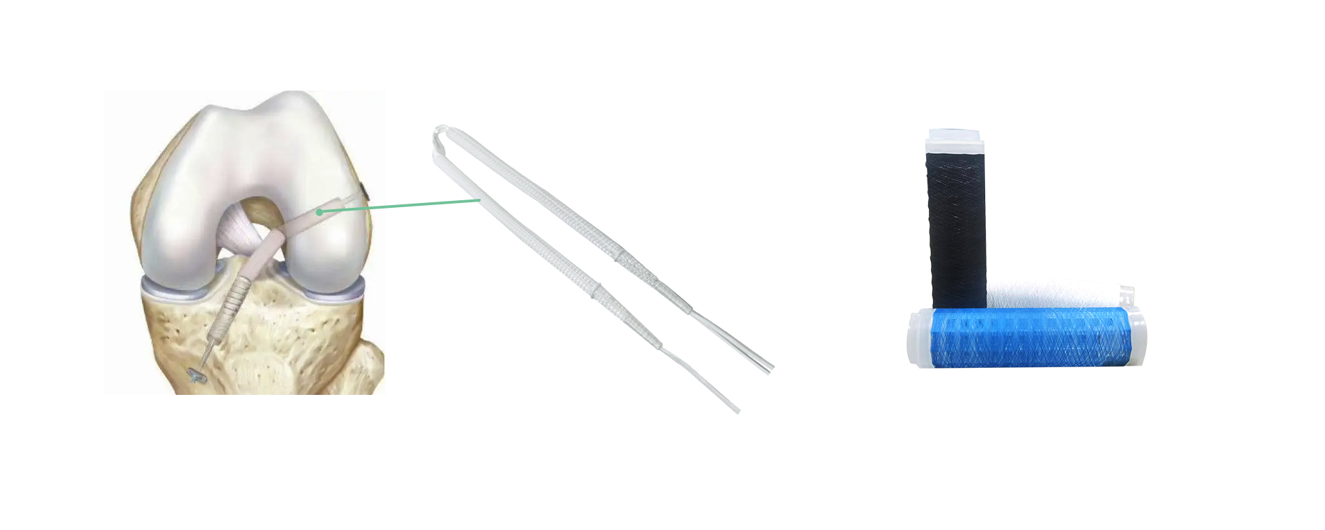 1762495216473356.jpg 官网运动医学.jpg